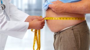 Cirurgia bariátrica quando realizar
