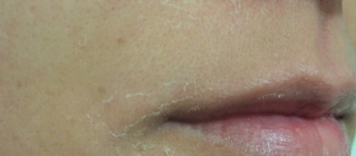 image-1 (1)