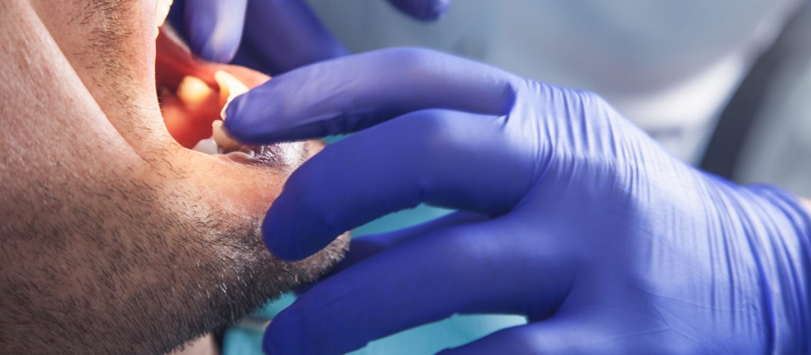 Work of dentist with patient. Survey of the teeth