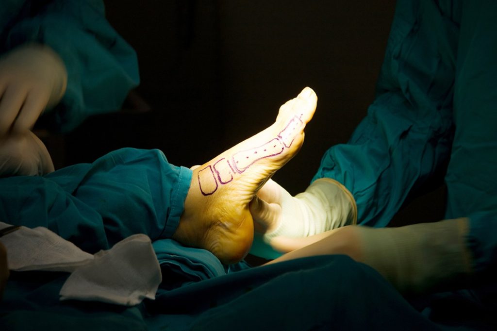 cirurgia de pé