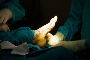 cirurgia de pé