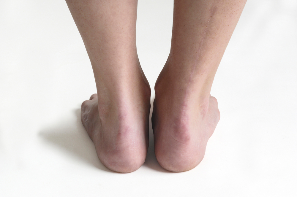 cirurgia de pé