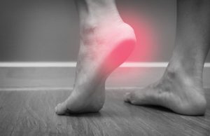 Fascite plantar