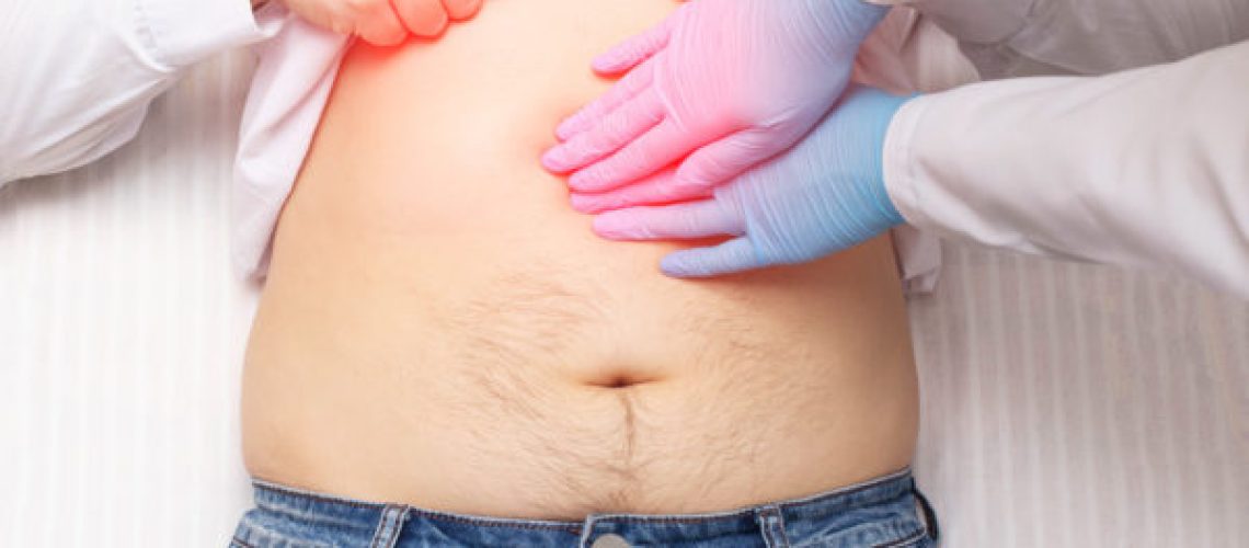 The doctor examines a patient who has abdominal pain. Pancreas inflammation concept, pancreatitis, close-up. Inflammation of the gallbladder and duodenum
