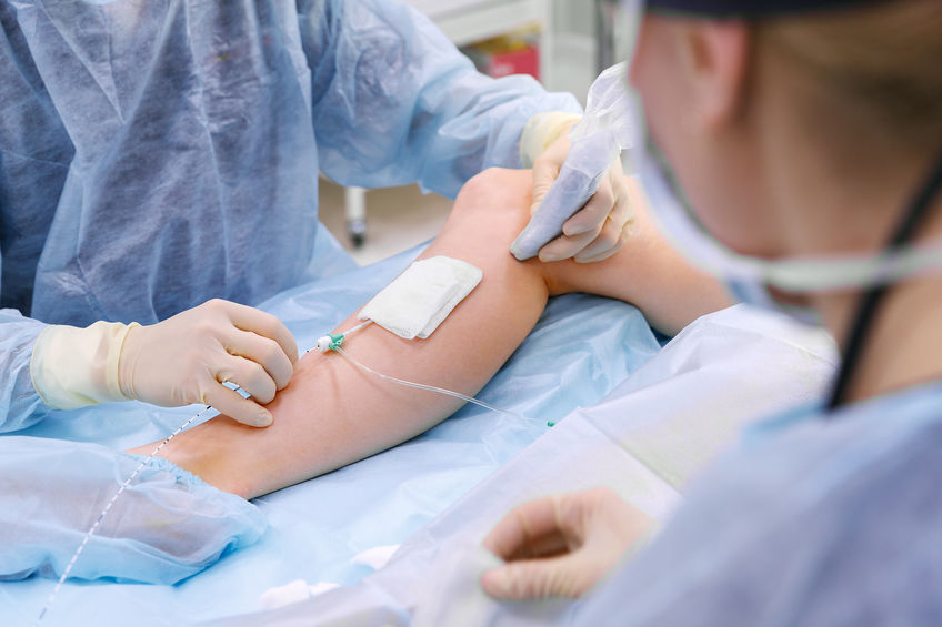 Crioescleroterapia