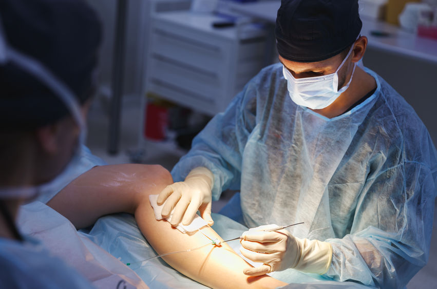 Escleroterapia com glicose