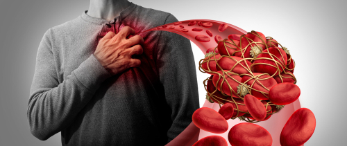 thrombosis