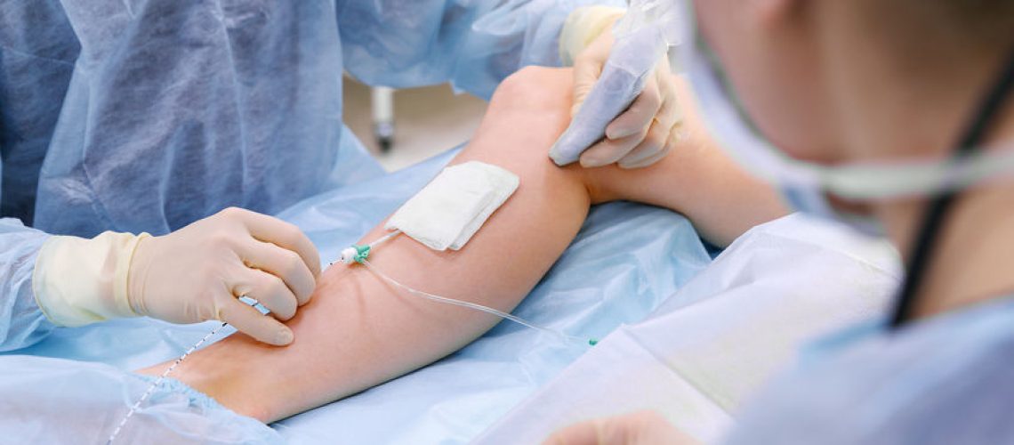Crioescleroterapia