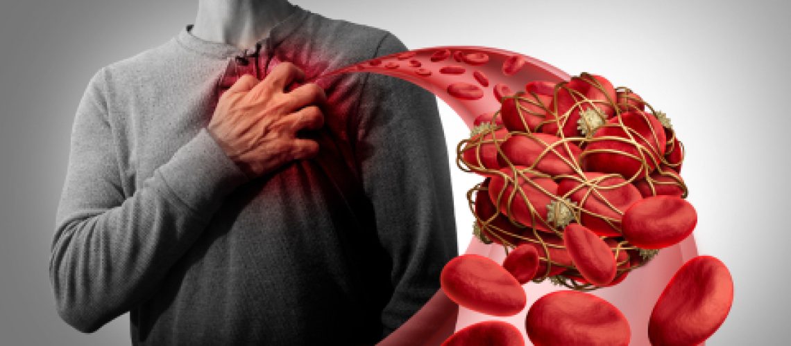 thrombosis