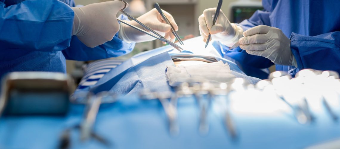 quando-a-cirurgia-de-vesicula-e-indicada