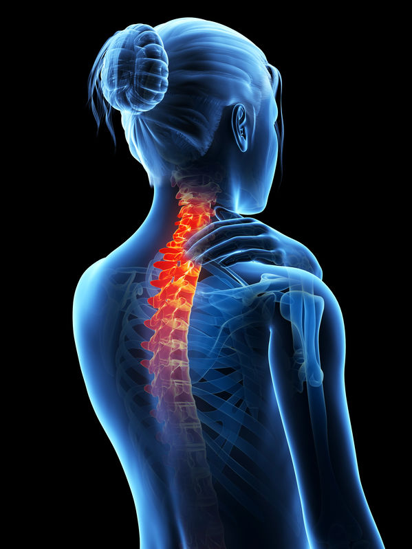 osteoporose