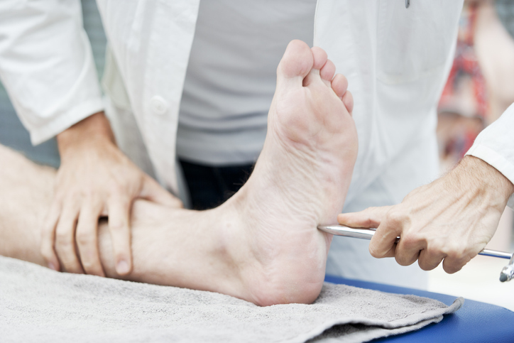 neuropatia