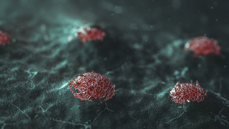 Tumor neuroendócrino