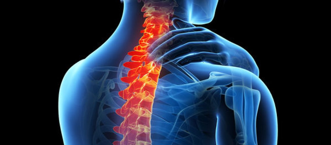 osteoporose