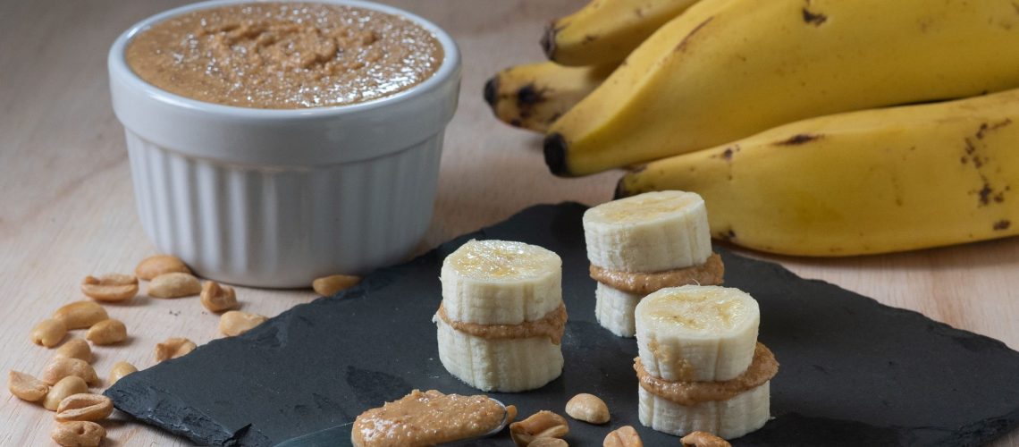 Nutrição funcional