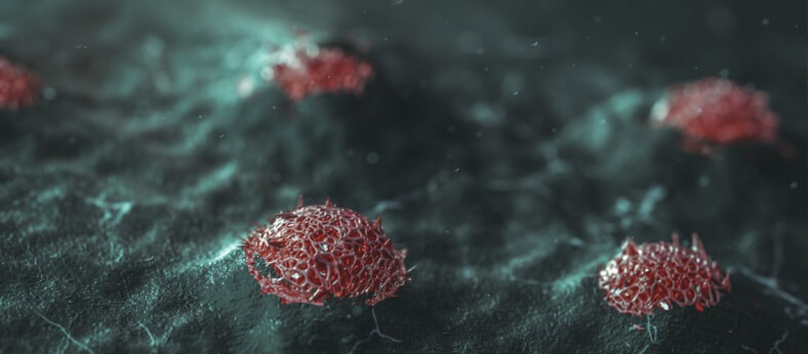 Tumor neuroendócrino