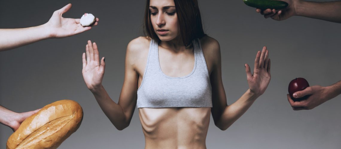 Anorexia nervosa