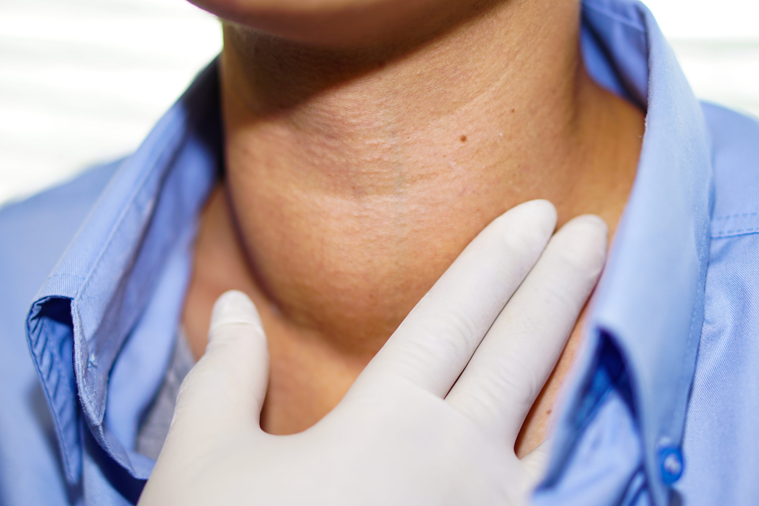 Tireoide