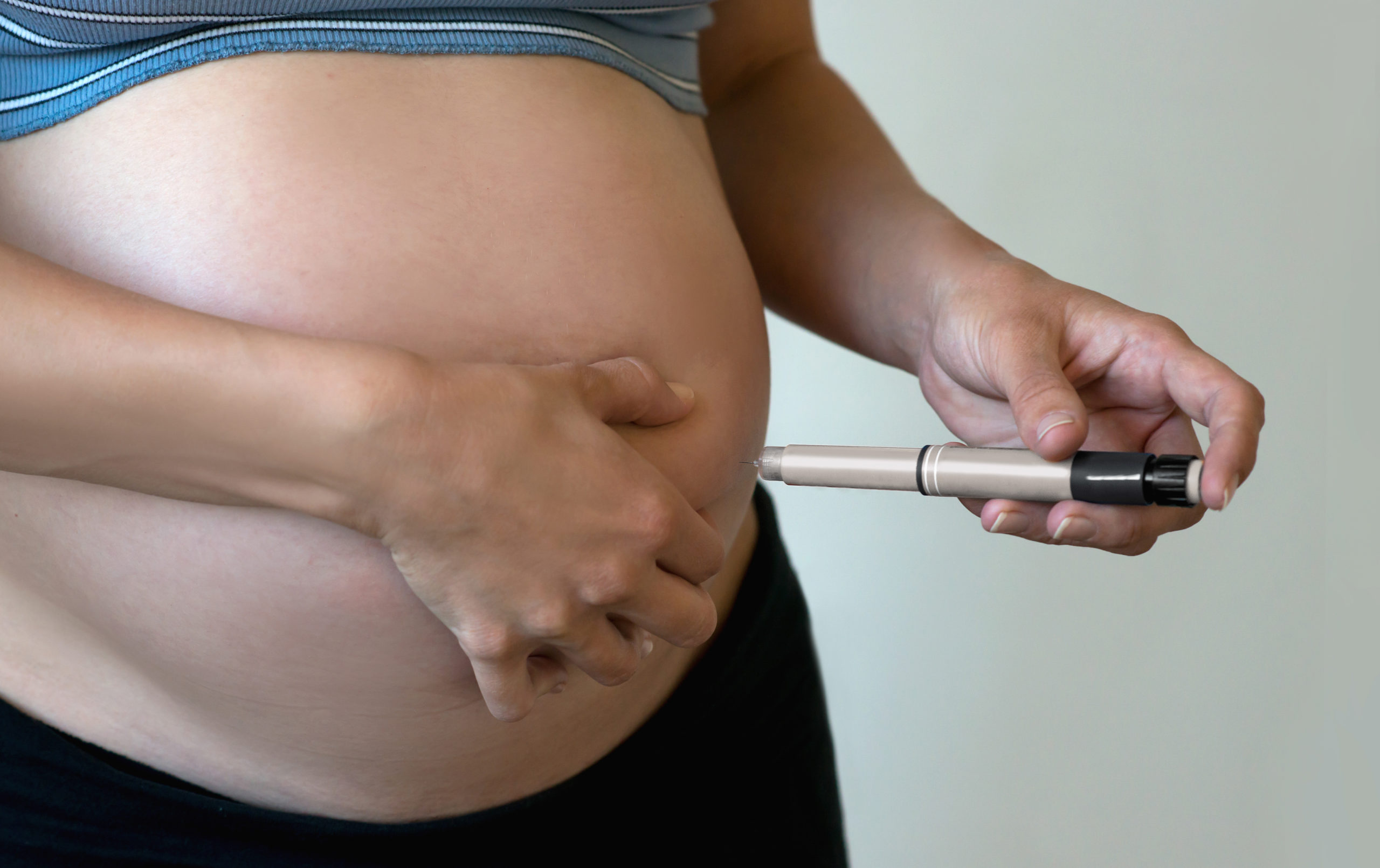 Endocrinopatias da Gestação 