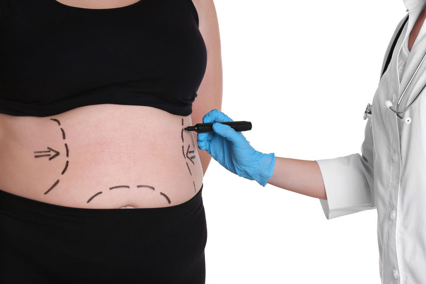 Cirurgia para emagrecimento
