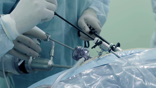 Cirurgia Colorretal por videolaparoscopia