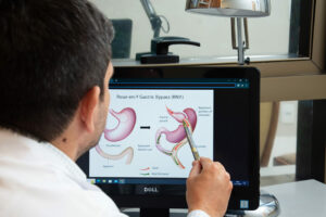 Cirurgia Geral - Videolaparoscopia  Cirurgia Bariátrica