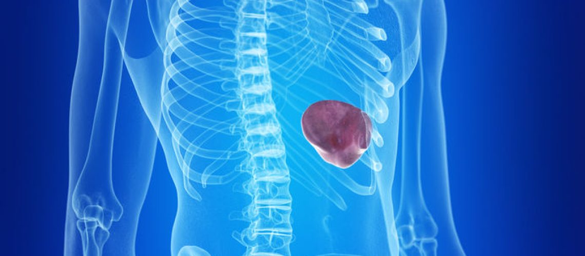esplenectomia