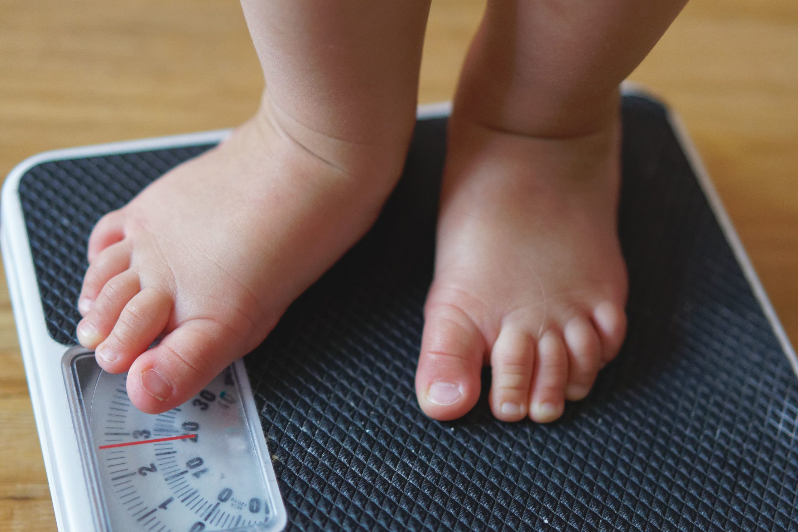 obesidade infantil
