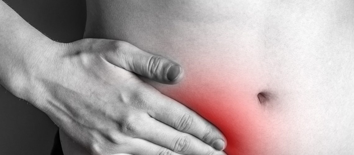 hernia estrangulada