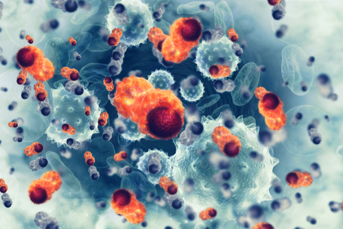 Carcinoma basocelular