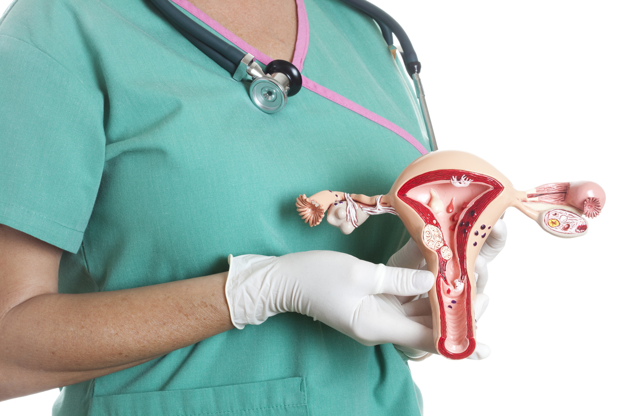 mioma uterino