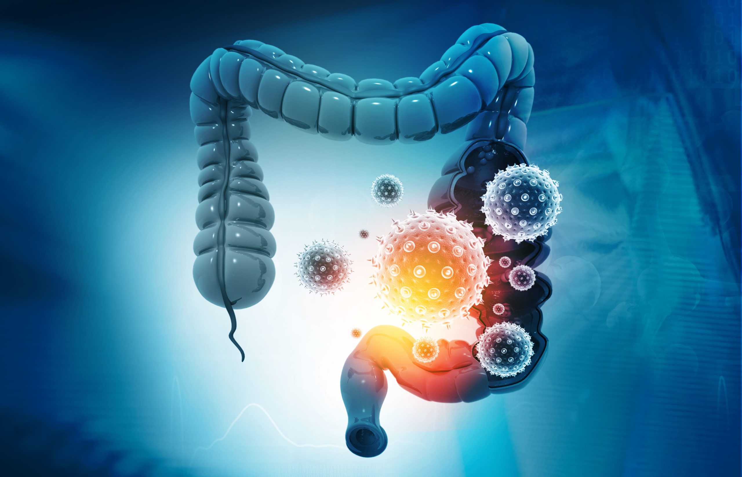 Câncer Gastrointestinal