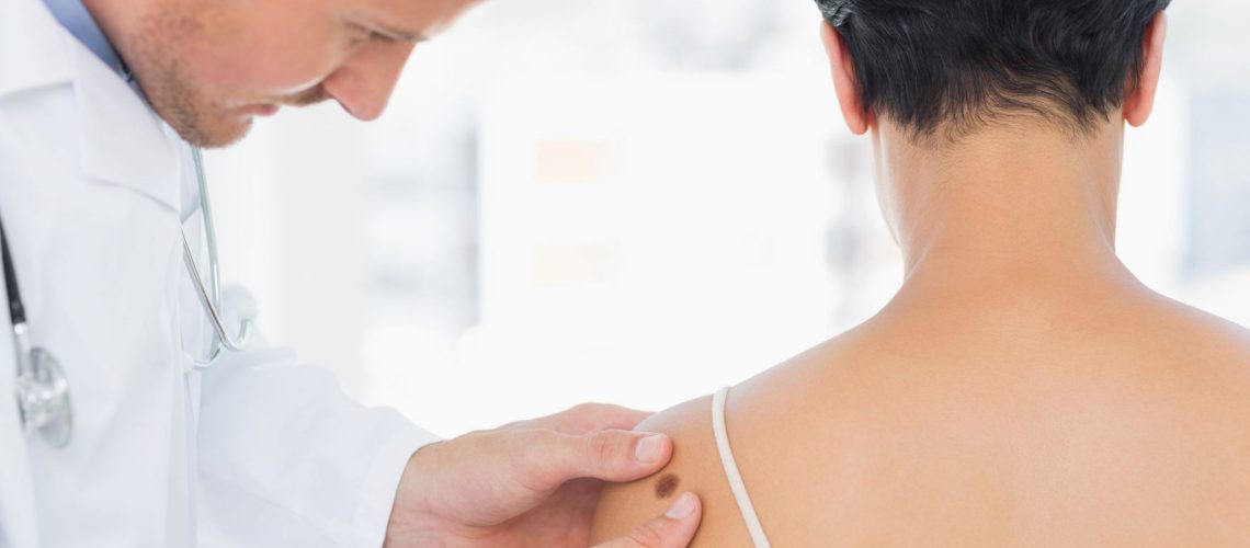 Melanoma