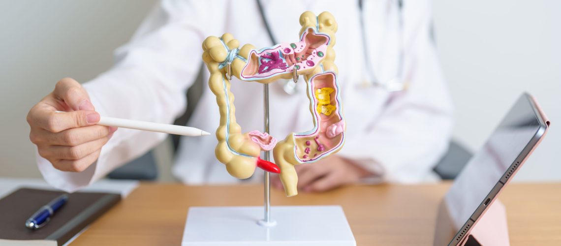 Síndrome do Intestino Irritável