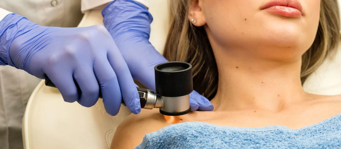 Dermatoscopia
