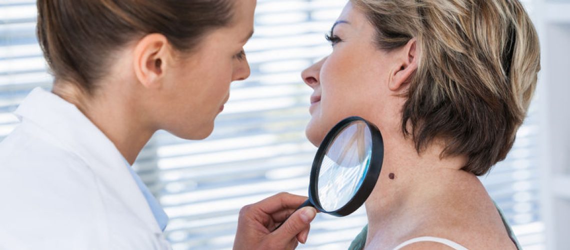 melanoma