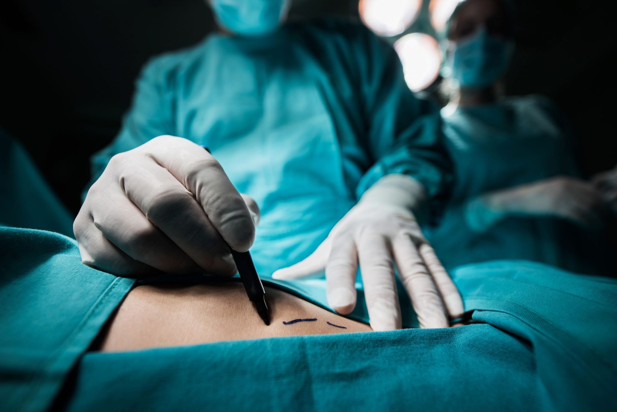 cirurgia bariátrica