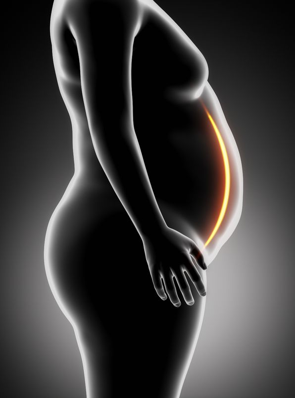 cirurgia bariátrica