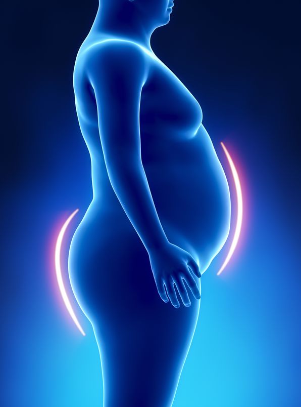 exercícios físicos e cirurgia bariátrica