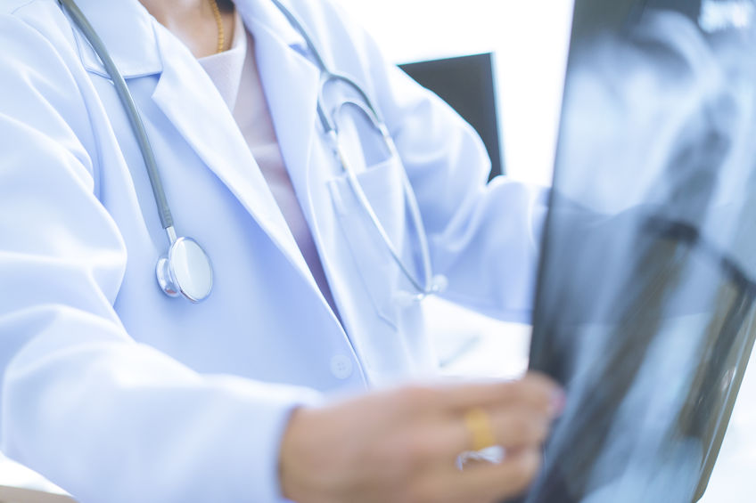 hernia diafragmática