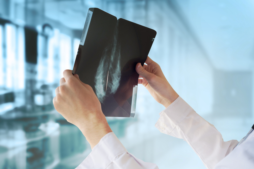 cirurgia para câncer de mama