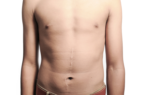 Cirurgia abdominal e hérnias