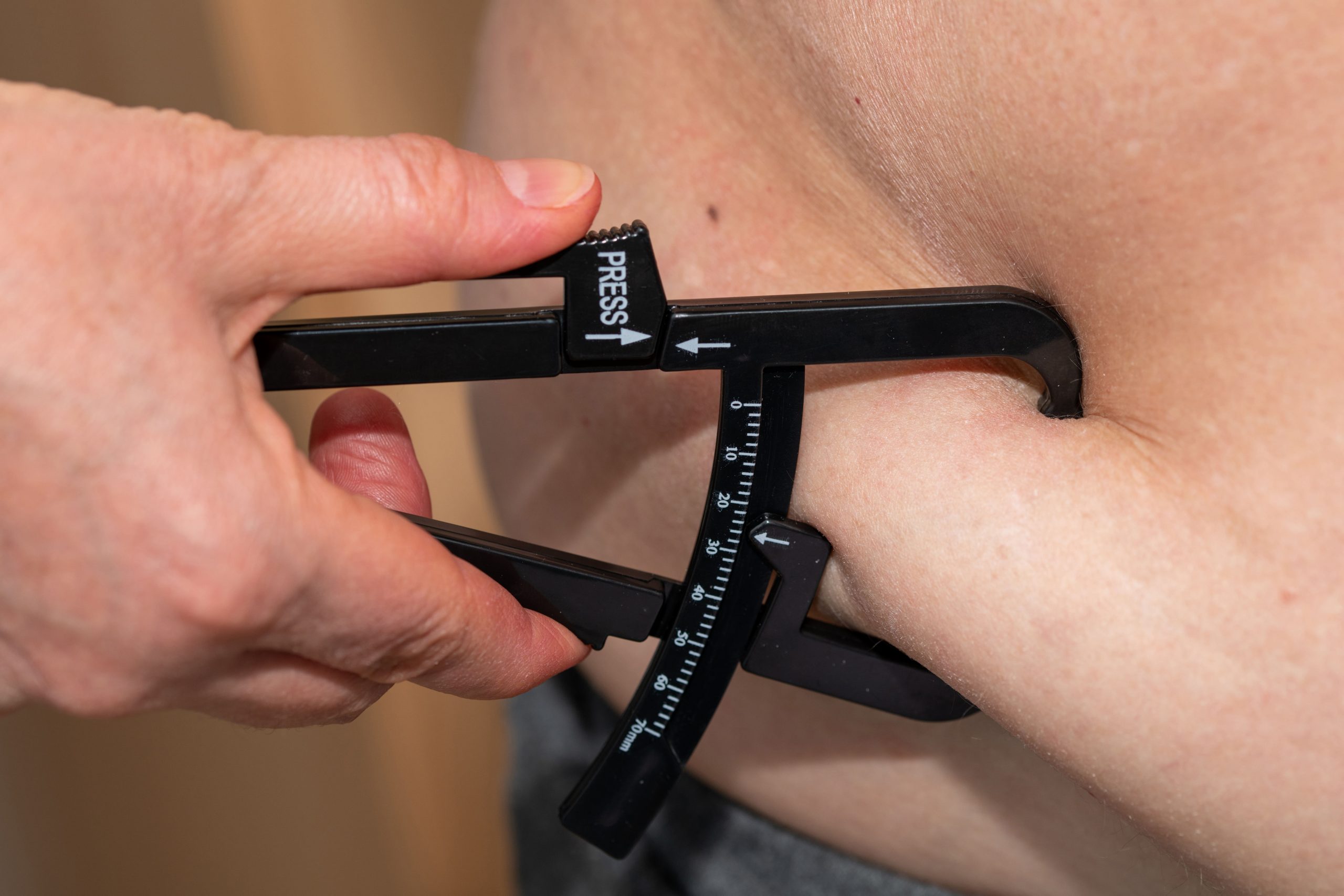 Cirurgia bariátrica