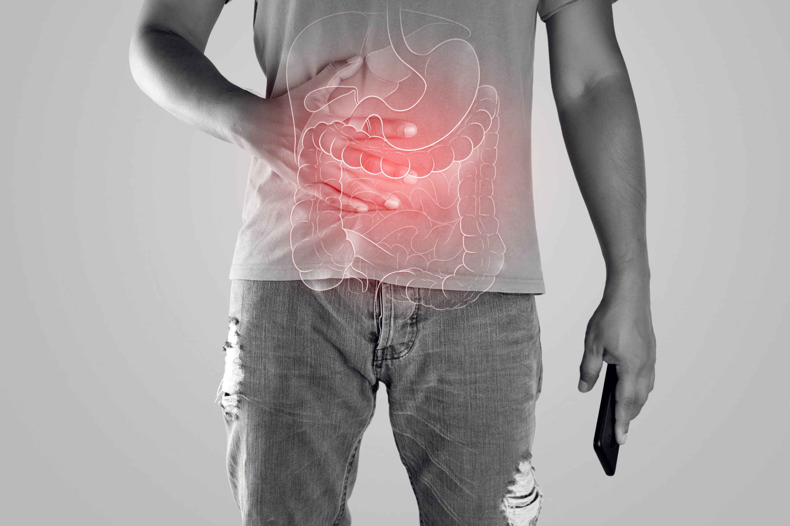 Doença De Crohn