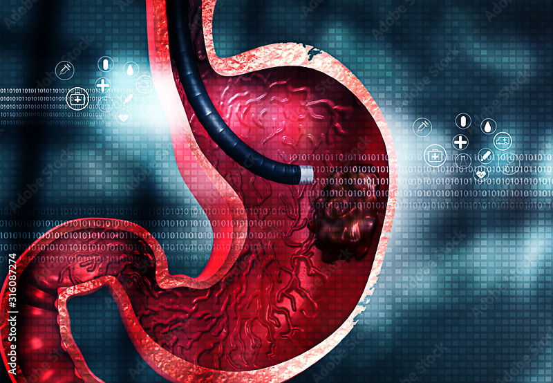 o que é o exame de endoscopia e qual a sua finalidade