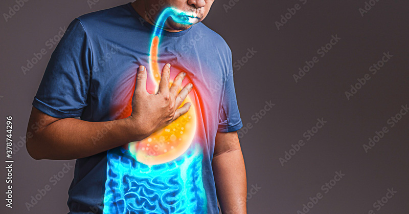 refluxo o que é e qual seu tratamento