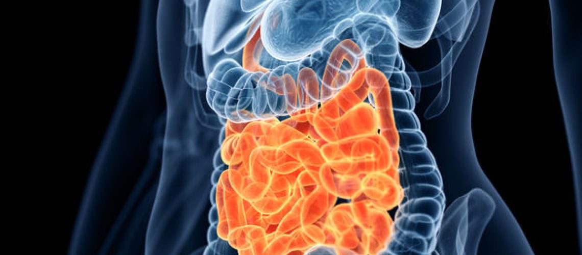 obstrução intestinal