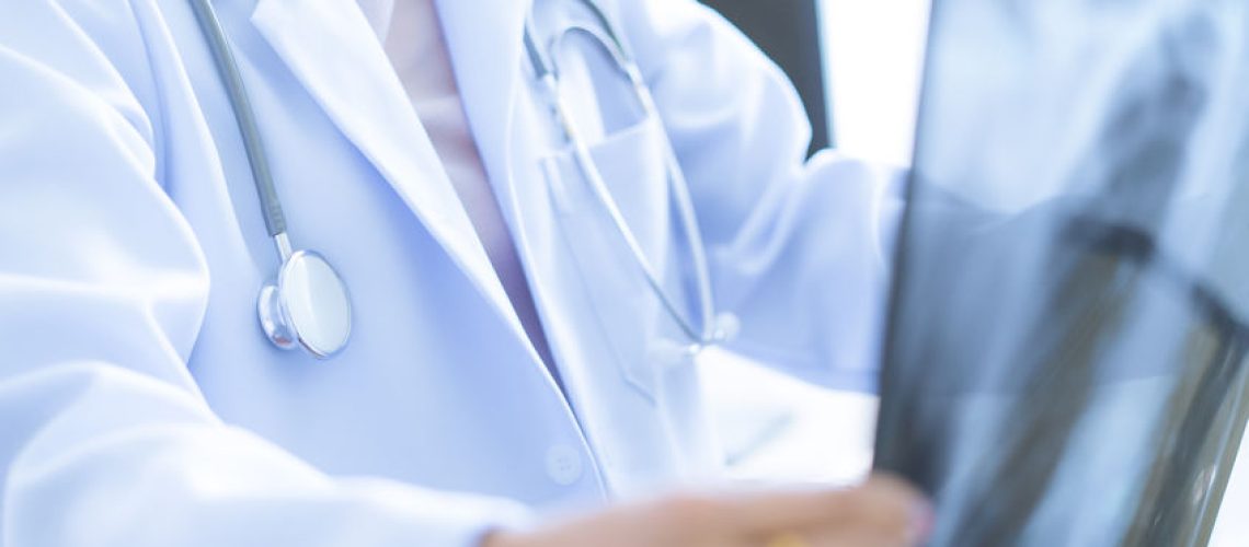 hernia diafragmática