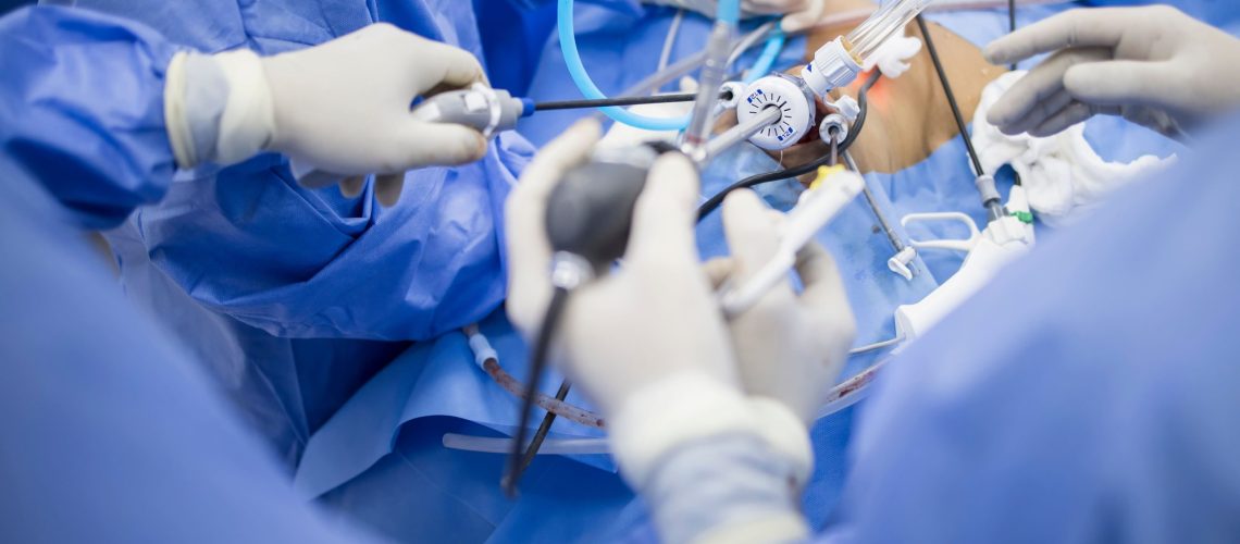 cirurgia bariátrica laparoscópica para obesidade