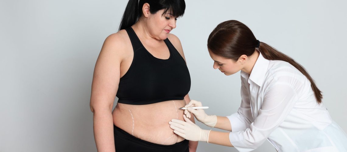 Cirurgia bariátrica